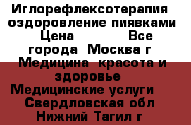 Иглорефлексотерапия, оздоровление пиявками › Цена ­ 3 000 - Все города, Москва г. Медицина, красота и здоровье » Медицинские услуги   . Свердловская обл.,Нижний Тагил г.